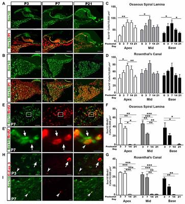 Macrophage-Mediated Glial Cell Elimination in the Postnatal Mouse Cochlea